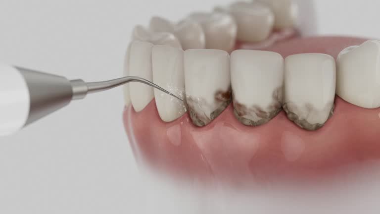 Trusted Teeth Cleaning And Checkup service in Constantine, MI - Dentist Open Now